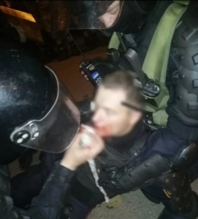 На сегодняшний день все пострадавшие силовики идут на поправку.