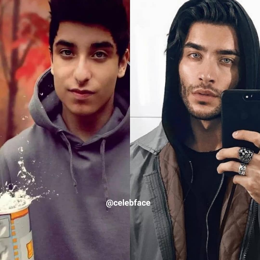 Хирурги описали пластические операции сестер Хадид, увидев их школьные фото