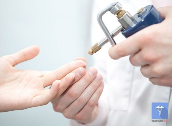 Криодеструкция