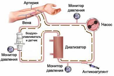 Схема аппарата,  сайт - ozhivote.ru