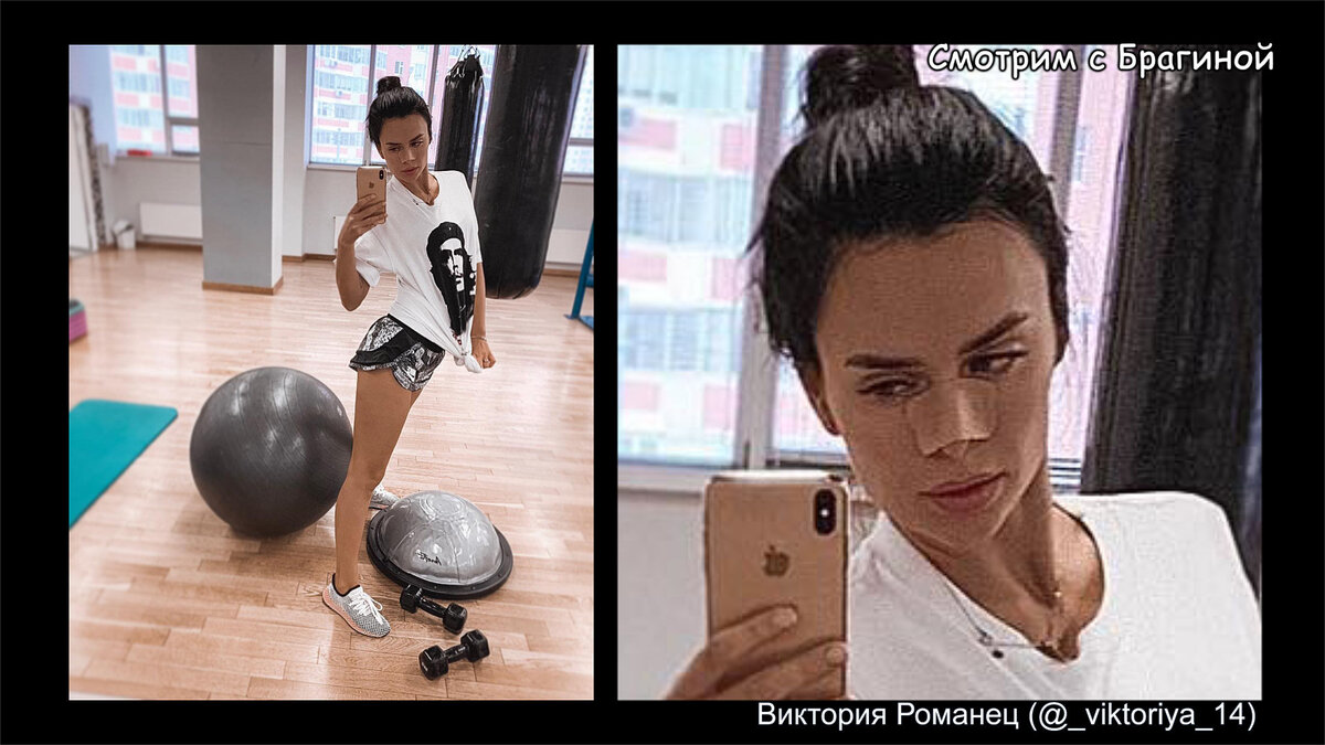 Вика вынуждена ходить с пластырем на носу. Фото: Виктория Романец (@_viktoriya_14)