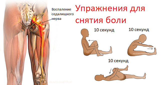 Снятие боли при ЗСН упражнениями.