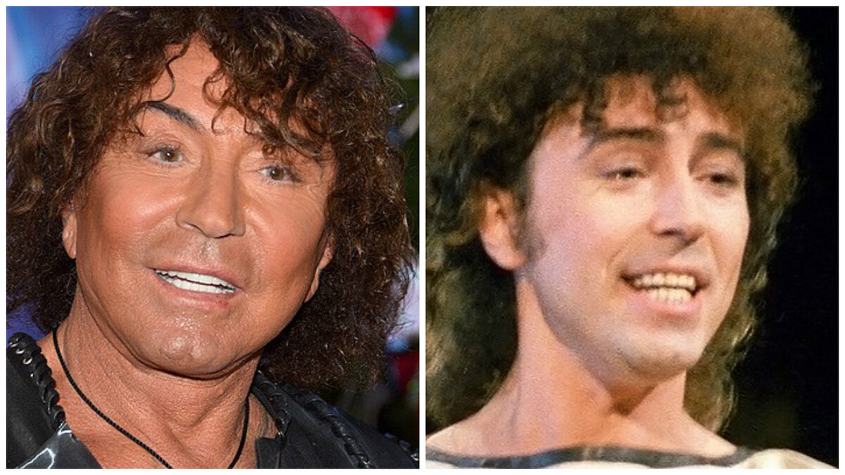 Валерий Леонтьев до и после пластики.