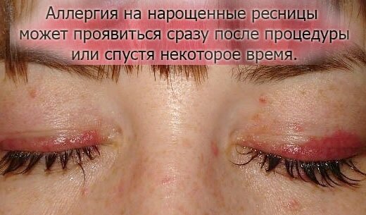 Источник фото: https://vseznayko.com/wp-content/uploads/2018/12/2ef2f8ebf4c191bcc49d8c8bc5618a22.jpg
 