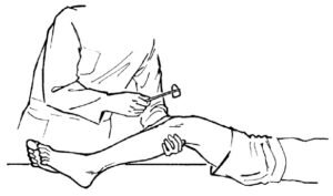 Менингеальные знаки носят такое название неслучайно, так как в подавляющем большинстве случаев причиной их проявления служит менингит. Для разных его форм характерны те или иные симптомы, но основу составляют именно менингеальные.