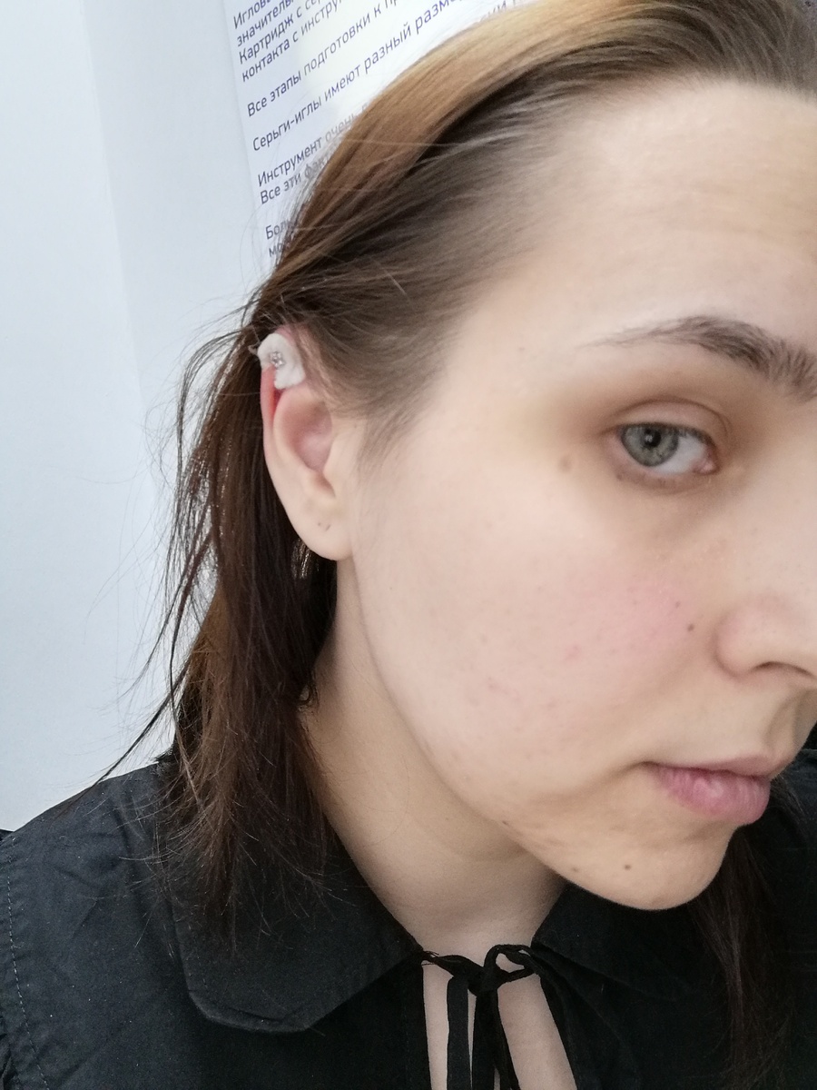 Тут видно явную отечность, овал лица немного "уплыл" 