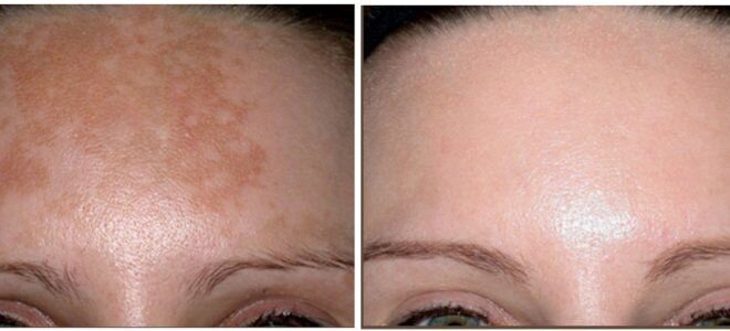 Фотография с сайта https://womanadvice.ru