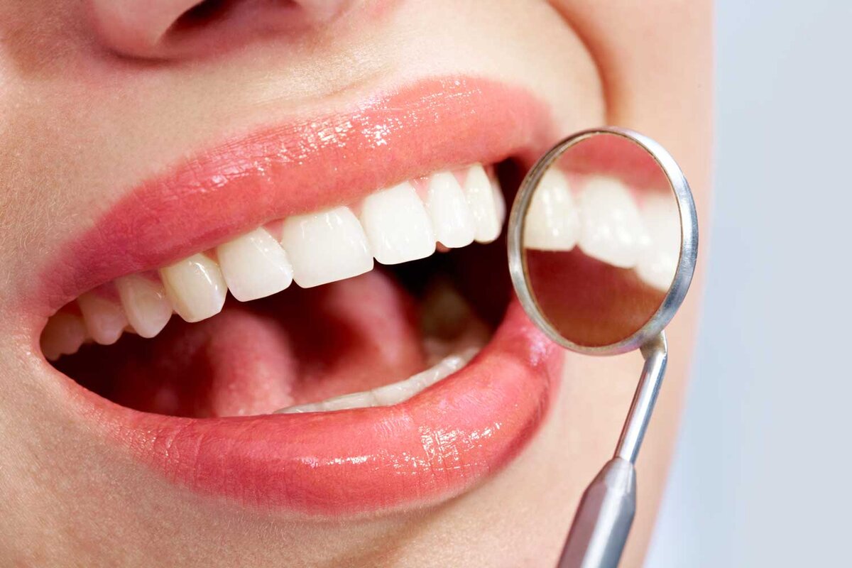 Как сделать улыбку белоснежной: советы стоматолога