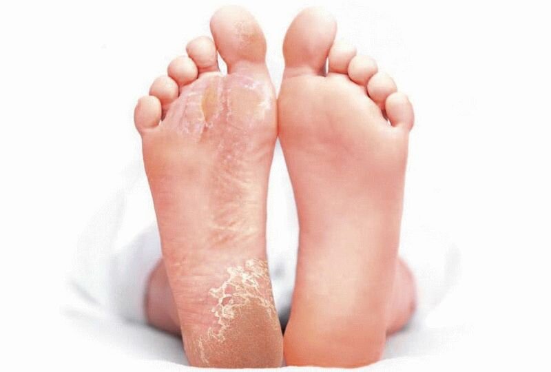 Google картинка