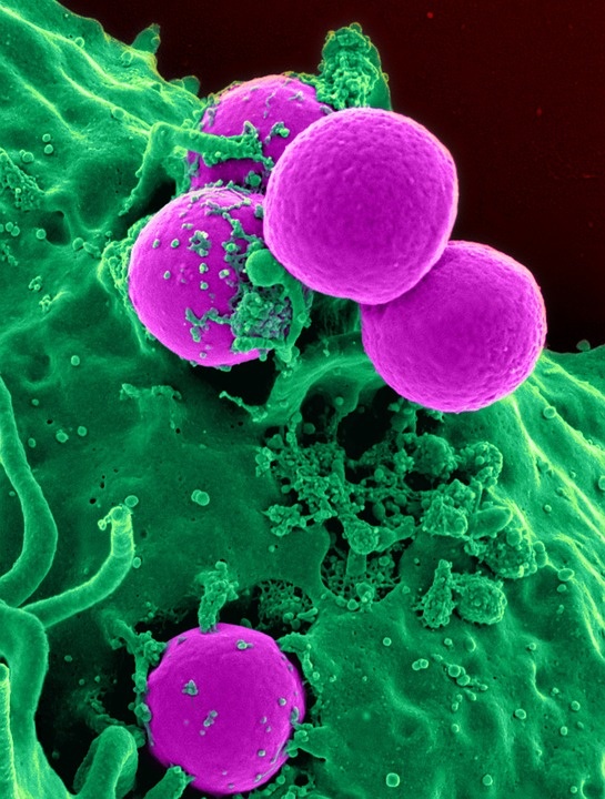 https://cdn.pixabay.com/photo/2014/11/24/03/06/white-blood-cell-543471_960_720.jpg
