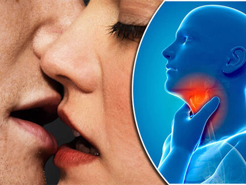 Мононуклеоз и его симптомы.