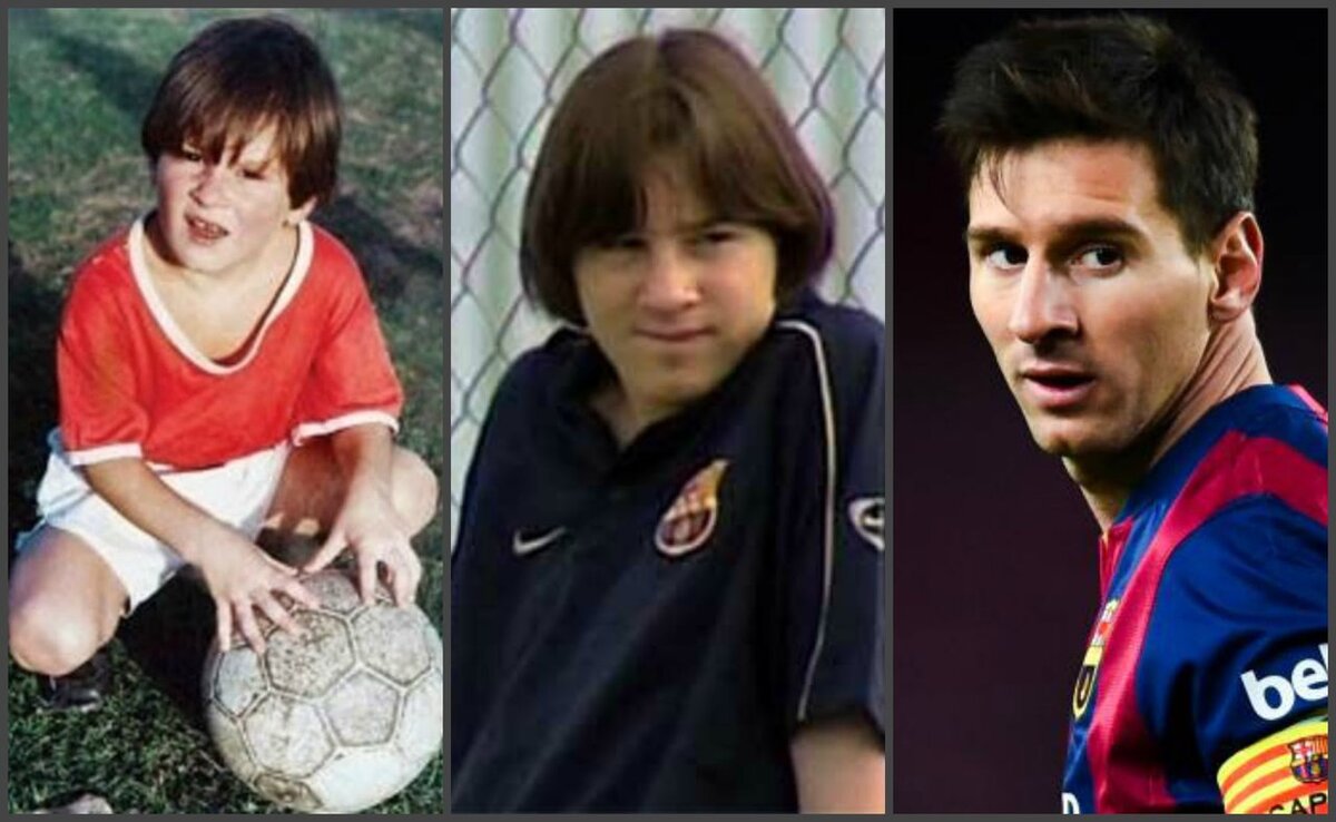 Messi Disease