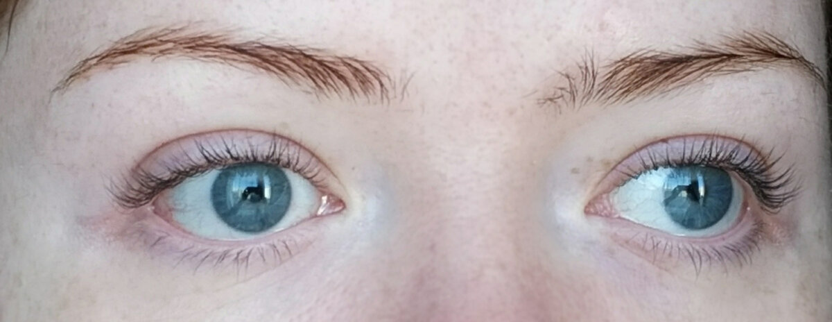 На второй день после умывания