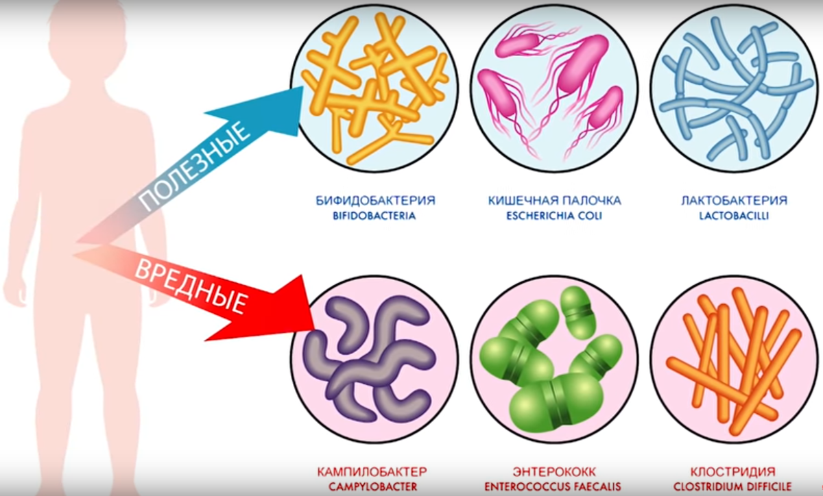 Какие-либо изменения в устоявшемся количестве микрофлоры в ЖКТ  человеческого организма приводит к ухудшению состояния организма  человека.