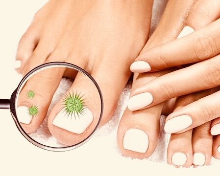 Грибковая инфекция — это не самое приятное событие в жизни человека. Не многие знают, чем лечить заболевание в домашних условиях, чтобы быстро избавиться от недуга. В этой статье я расскажу вам о некоторых методах, как избавиться от грибка в домашних условиях. 