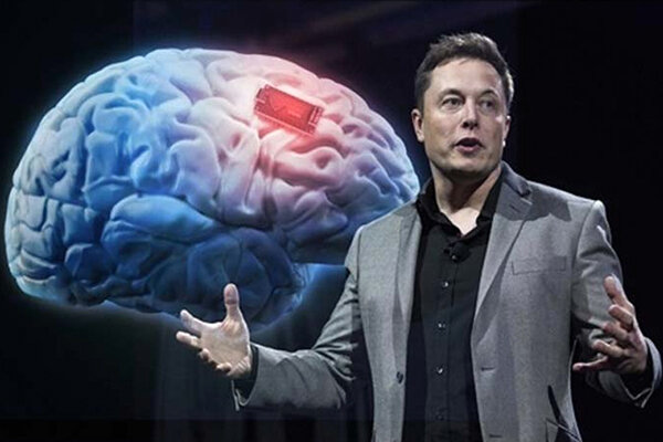 Neuralink скоро может быть имплантирован первым людям-добровольцам 