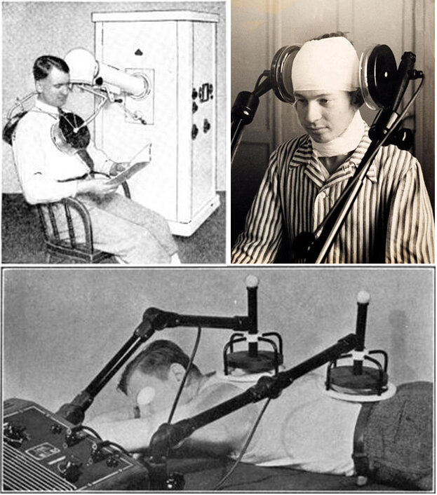 Аппараты для диатермии 1930-1940 годов