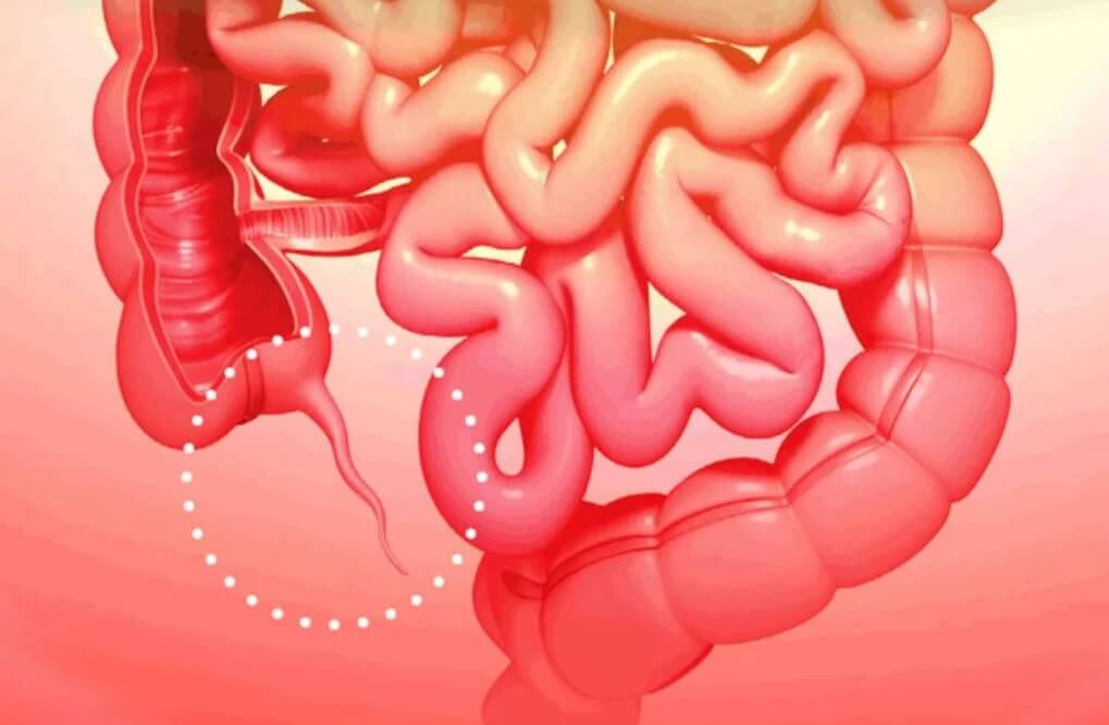 Где находится аппендикс