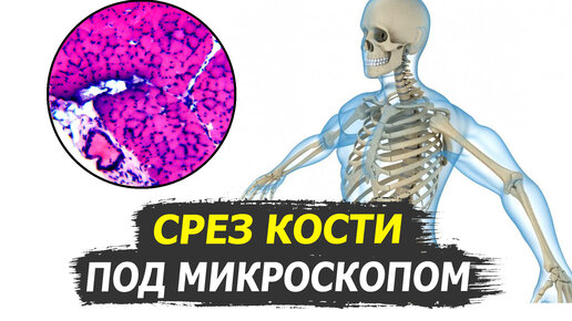 🔬 Срез кости под микроскопом