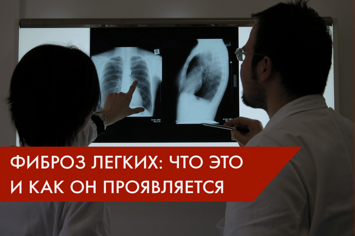 Фиброз легких: что это такое, почему он возникает и что с ним делать? | Dr.  Kichinsky. О здоровье и медицине | Дзен