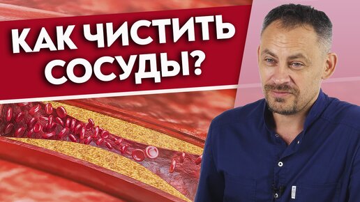 Как снизить ХОЛЕСТЕРИН? Опасные заболевания сердца и сосудов. Плохой и хороший холестерин.