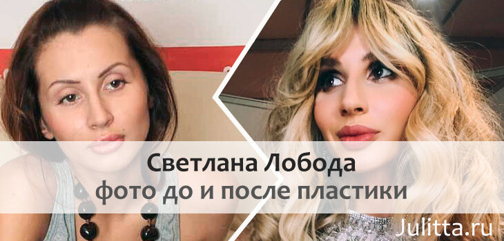 Светлана Лобода и её пластические операции. Что сделала певица, чтобы стать такой популярной?