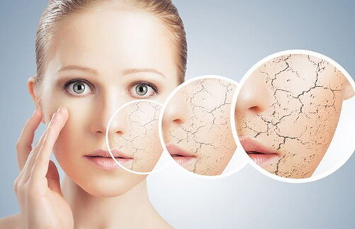 Лучшие увлажняющие и питательные маски: ТОП-3 масок для сухой кожи лица