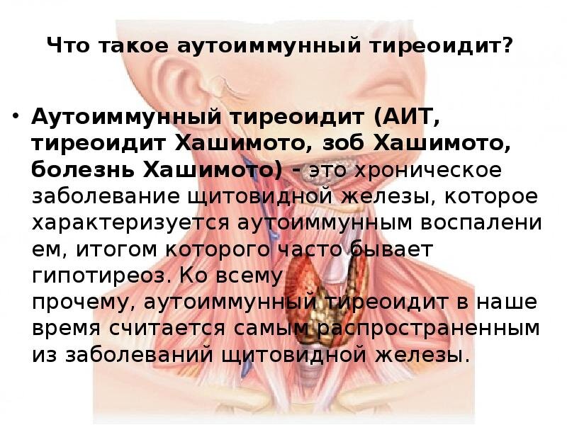 Болезни щитовидной железы — симптомы, диагностика, лечение в НКЦ№2 (ЦКБ РАН)