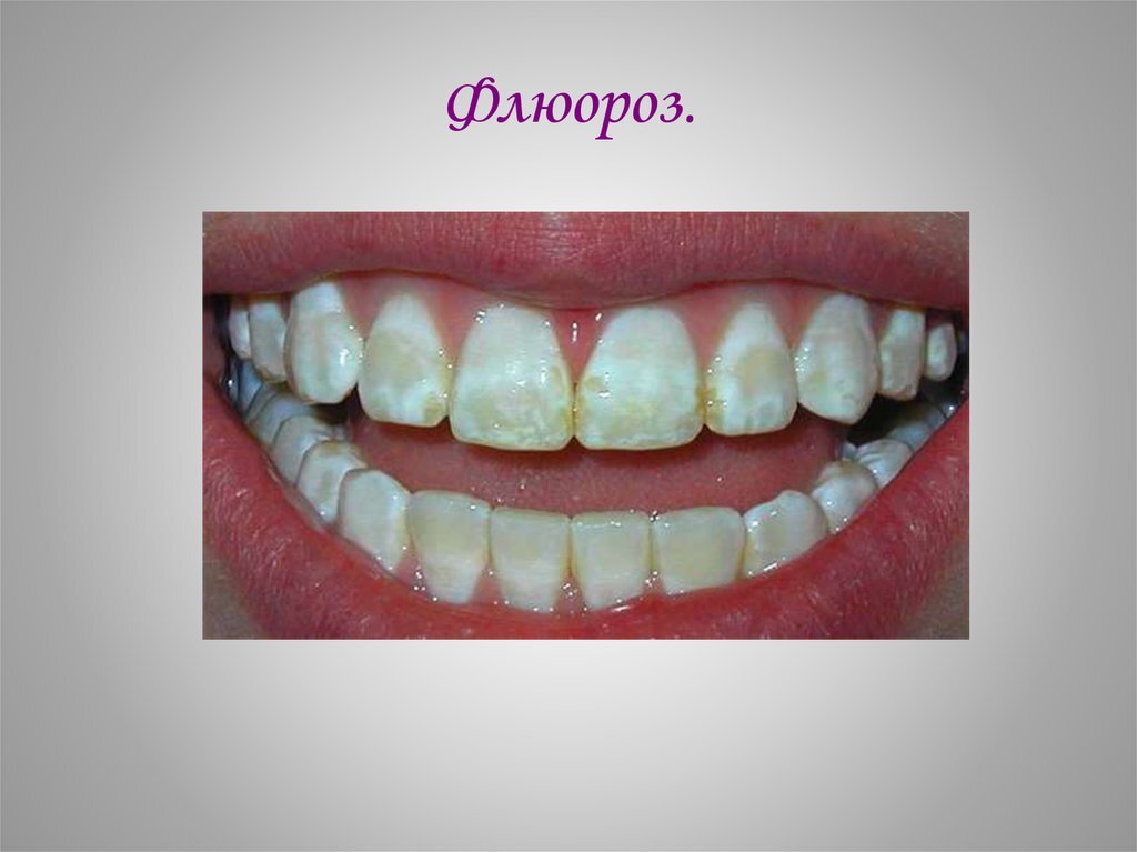 Фото: из интернета