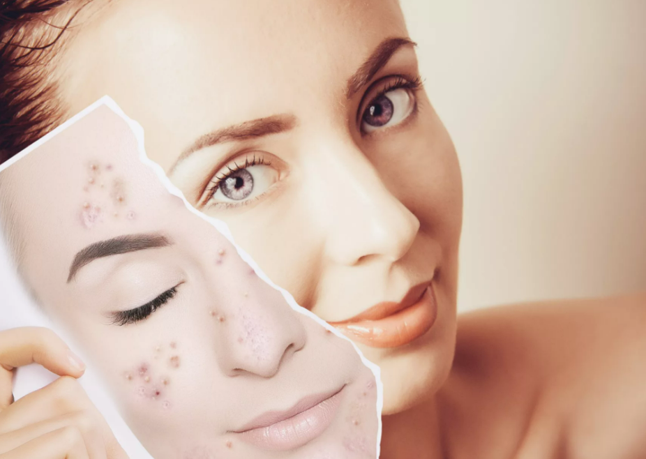 Фотография взята из источника za-rozhdenie.ru