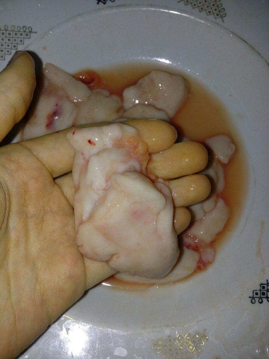 Рыбные молоки очень полезны при простатите и импотенции