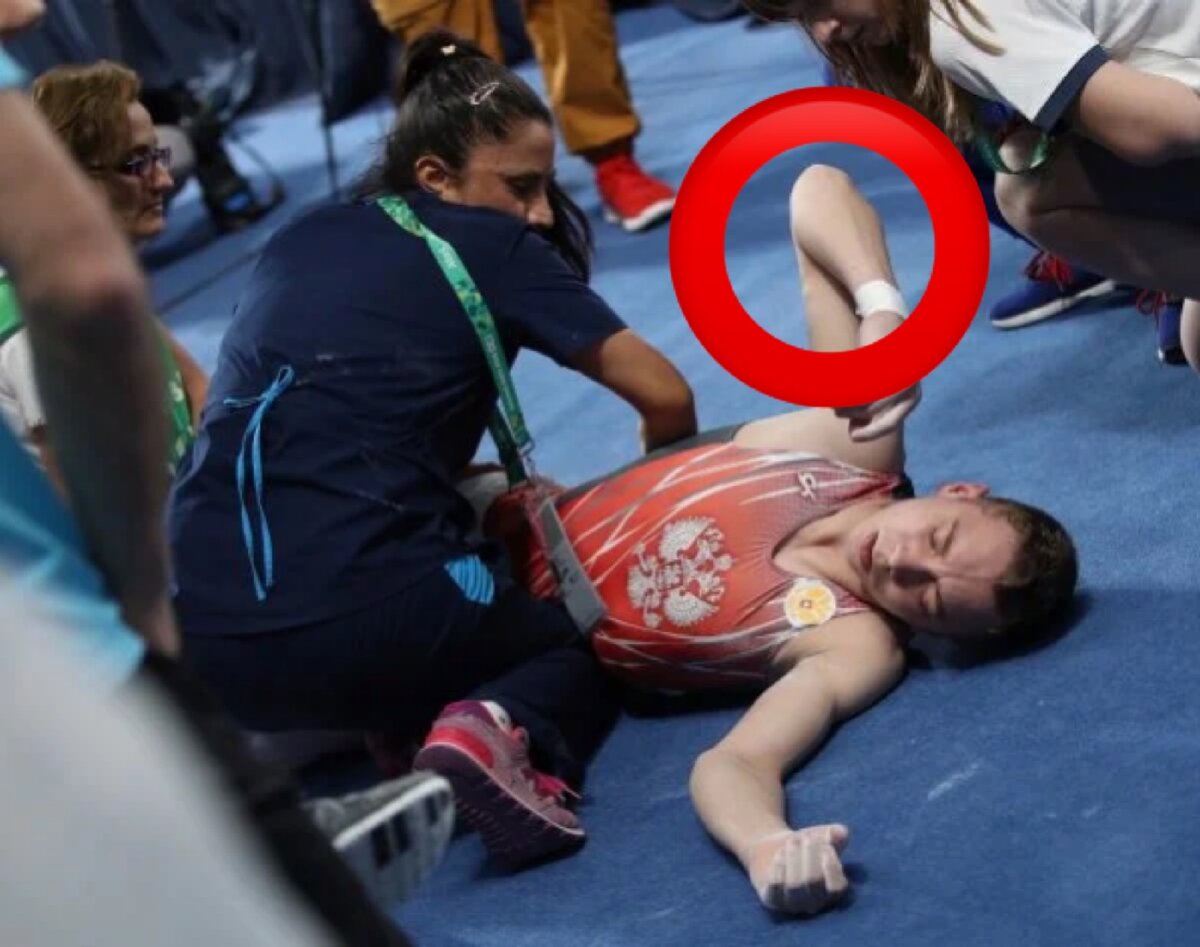 Получил травму от неправильного отжимания на брусьях 