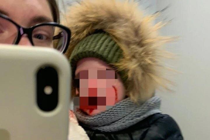 Фото без блюра можно посмотреть в телеграмм @trashem2