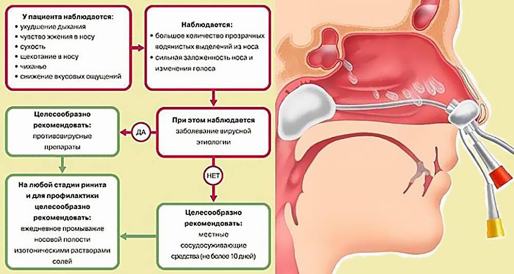 У ребенка течет из носа сопли. Аллергический ринит симптомы. Аллергический ринит симптомы у детей. Аллергический ринит в носу.