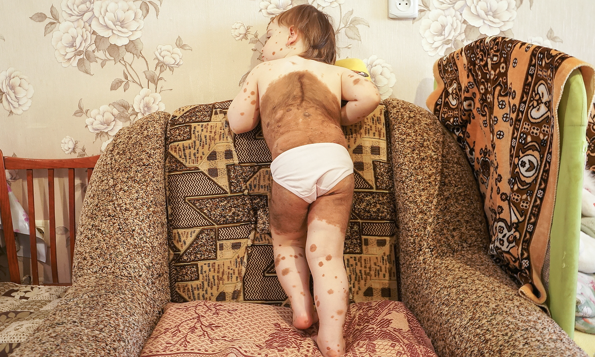 Вероника Янковая, маленькая подопечная фонда "Алёша"