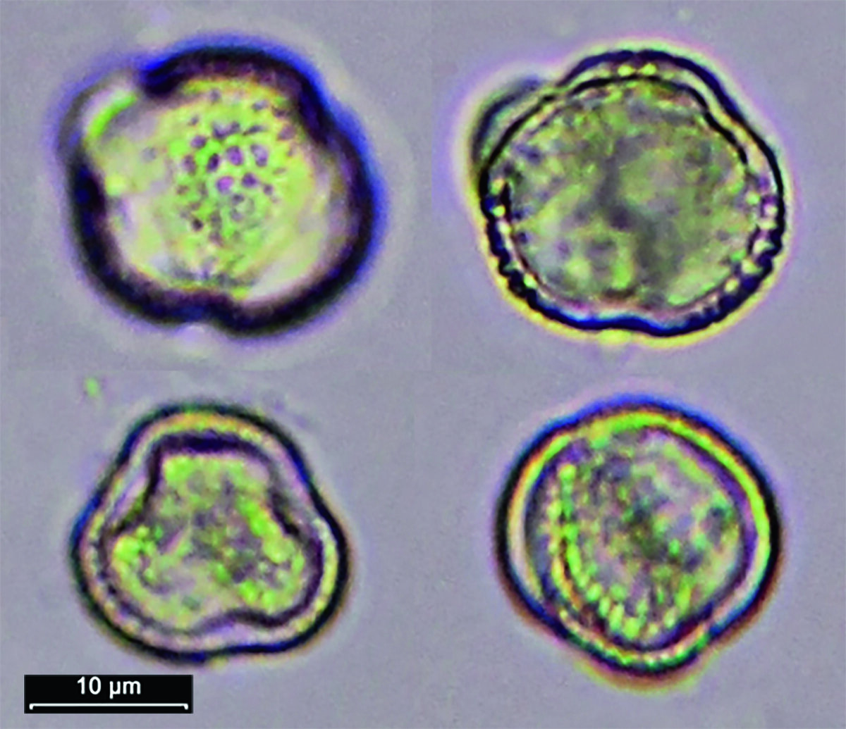 Пыльца ивы под микроскопом  (фото Р.Г. Курманова)