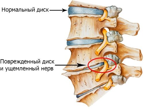 Гимнастика Шишонина для шеи без музыки с сигналами | Клиника доктора Шишонина