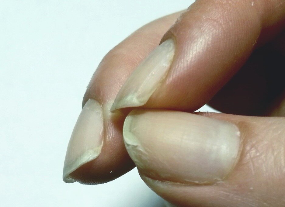 Эффективные способы укрепить ногти в домашних условиях