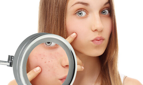 Источник фото: http://maskifaceskin.ru