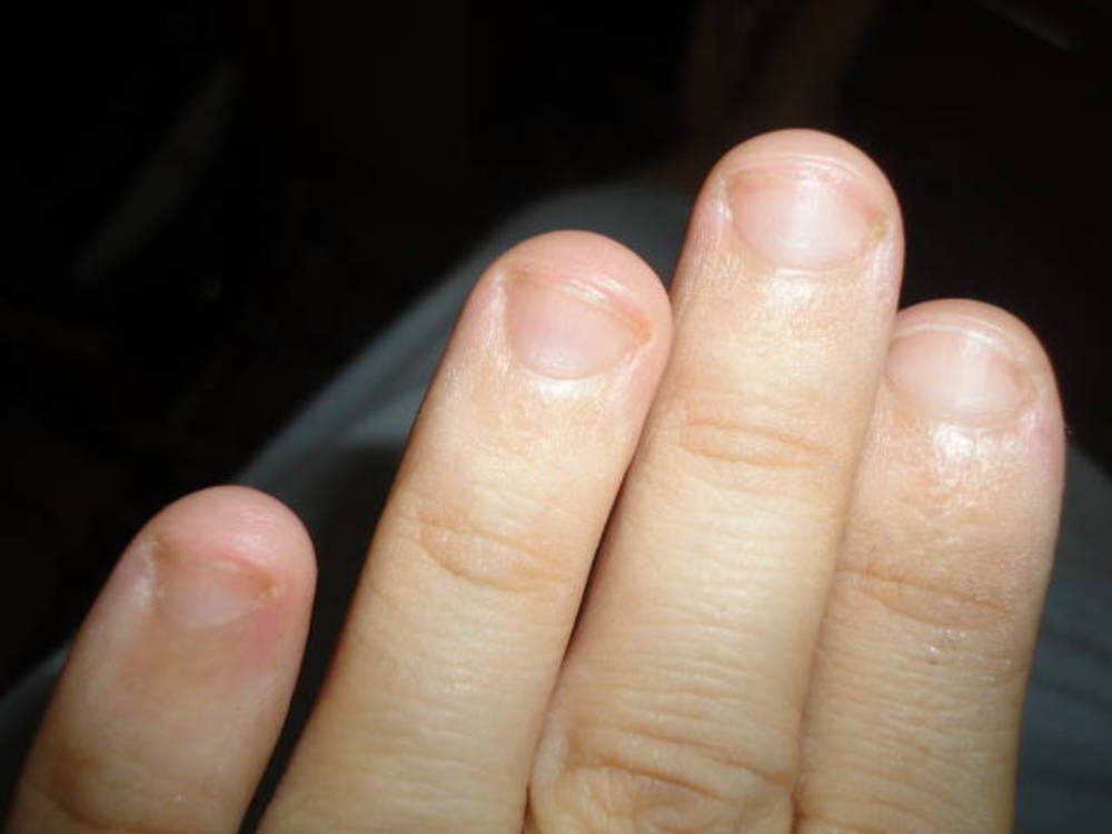 Примерно такие ногти у меня были. Фото из интернета.