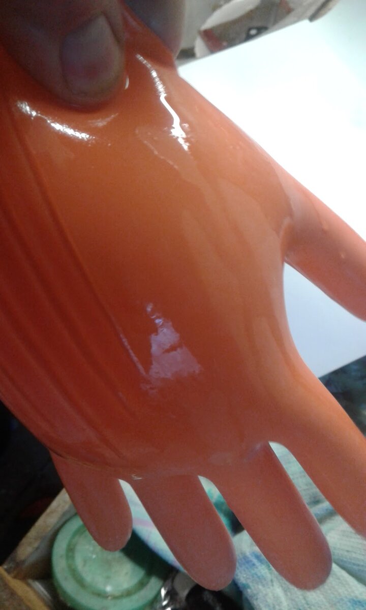 Перчатку распирает от гипса.