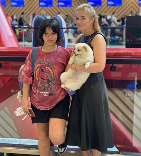 На данном фото слегка заметный порезы. Фотография была сделана прямо перед отправкой дочери в языковую школу