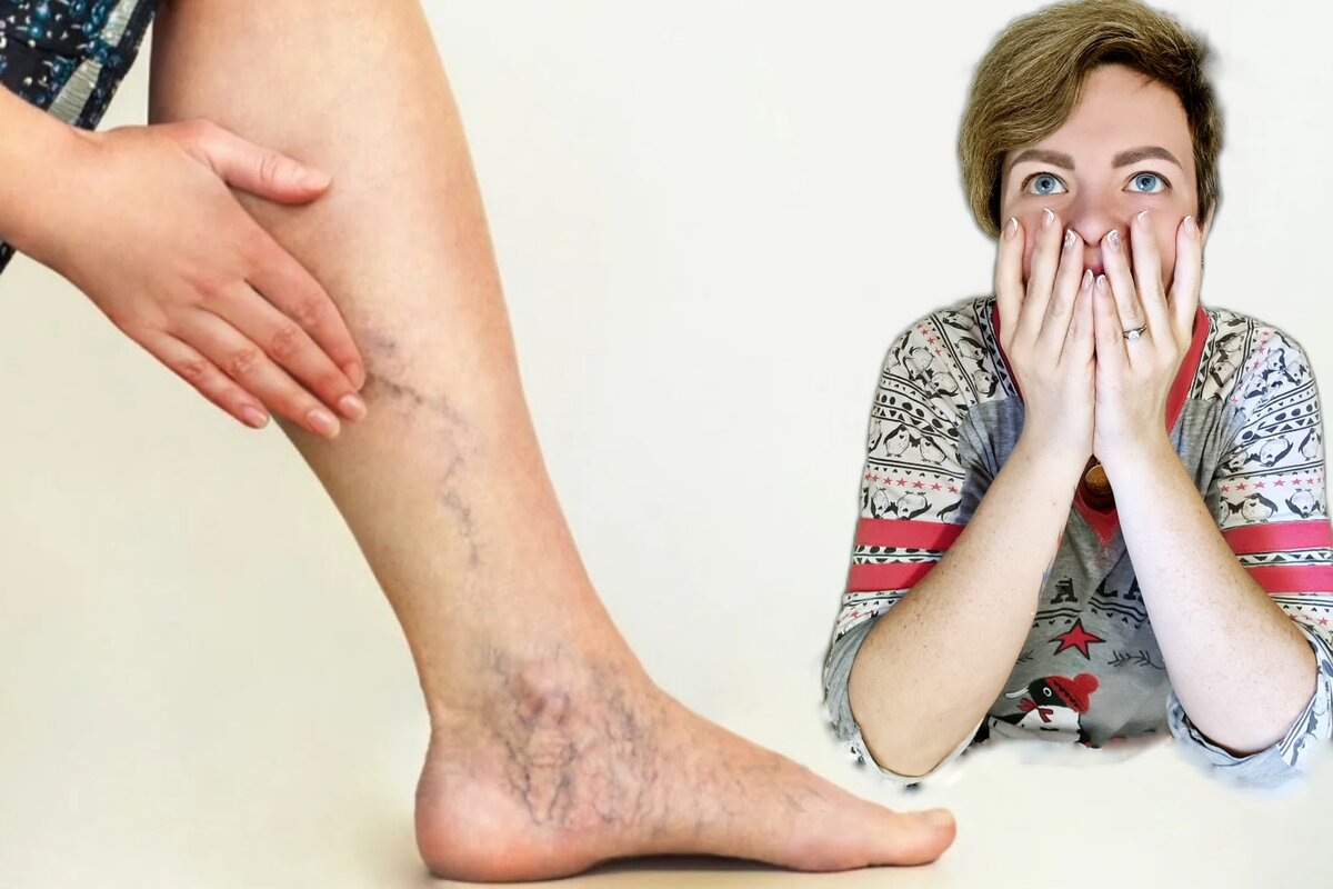 Тромбы — очень неприятная штука 