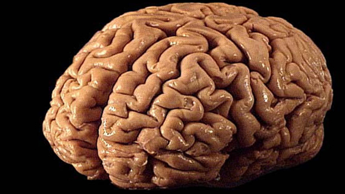 Большие полушария- картинка взята из интернета