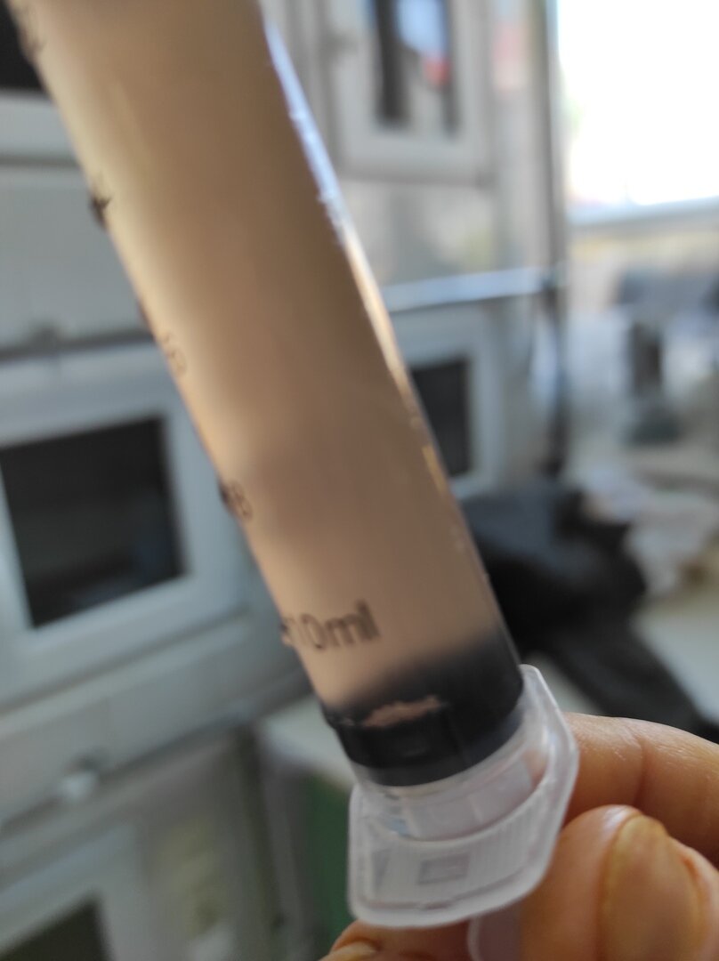 Вот такой неприятный осадок оказался в шприце... (Фото из личного архива автора).