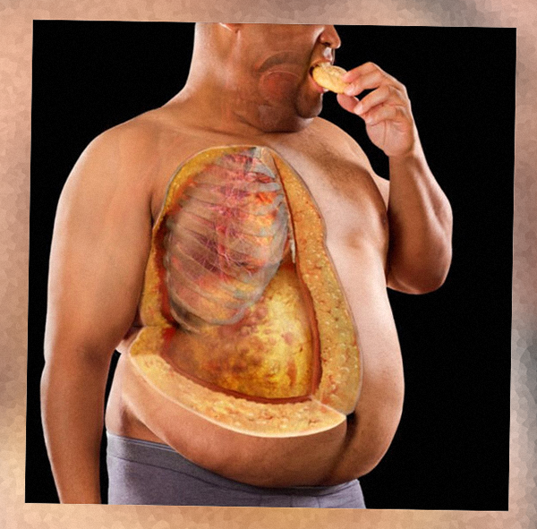 Жир внутри нас - Клиника Марины Рябус