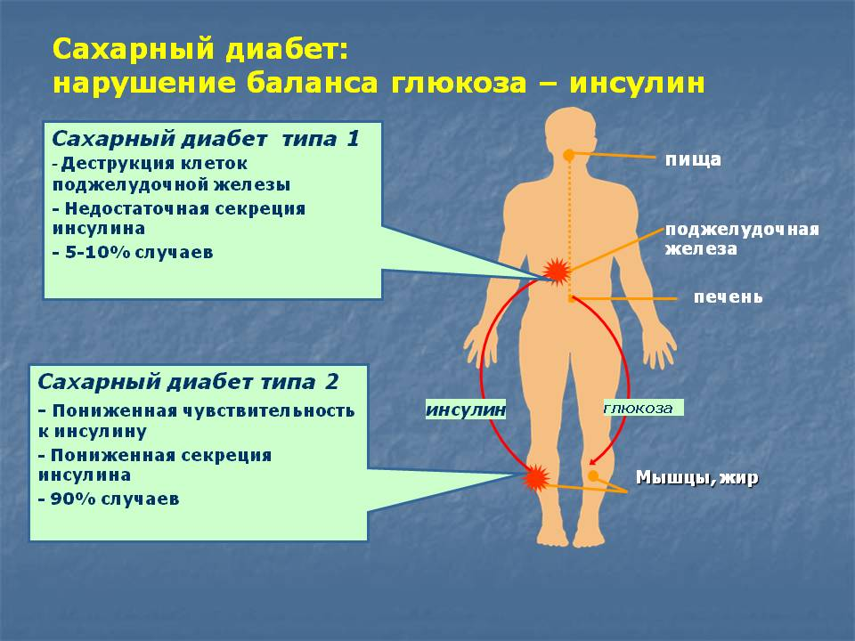 Диабет презентация. Презентация на тему сахарный диабет. Сахарный диабет эндокринное заболевание. Доклад на тему сахарный диабет.