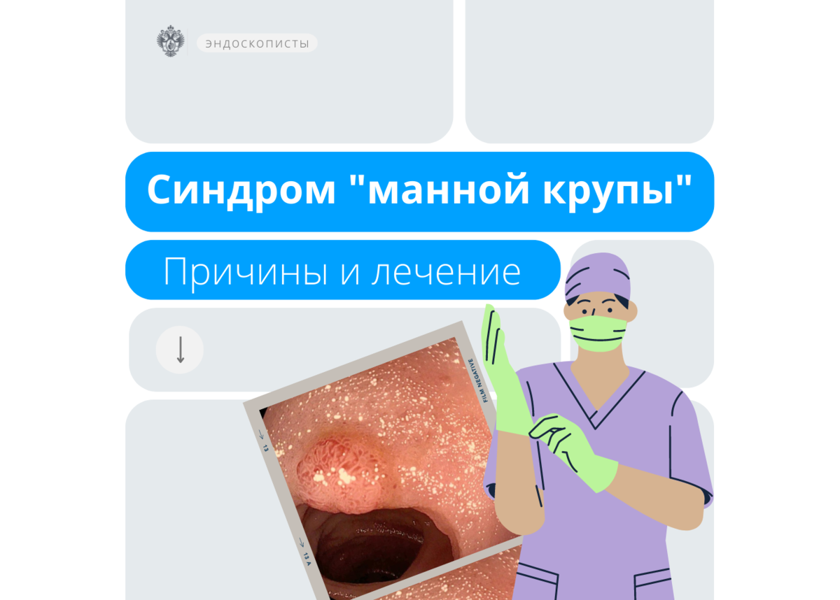 Синдром "манной крупы": причины и лечение | Клиника Пирогова СПбГУ | Дзен