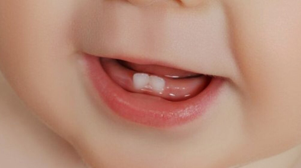 Сыпь при прорезывании зубов