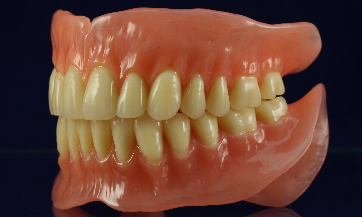 К чему снятся выпадающие зубы — кажется, у науки есть ответ - вторсырье-м.рф